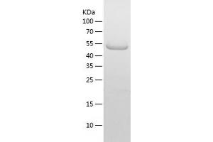 Western Blotting (WB) image for ATG14 Autophagy Related 14 (ATG14) (AA 1-492) protein (His tag) (ABIN7287711) (ATG14 Protein (AA 1-492) (His tag))