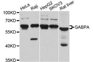 Western blot analysis of extracts of various cell lines, using GABPA antibody. (GABPA antibody  (AA 1-100))