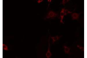 ABIN6274451 staining Hela by IF/ICC. (CNKSR2 antibody  (Internal Region))