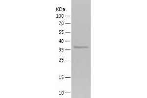 Western Blotting (WB) image for Carnosine Dipeptidase 1 (Metallopeptidase M20 Family) (CNDP1) (AA 28-147) protein (His-IF2DI Tag) (ABIN7282339) (CNDP1 Protein (AA 28-147) (His-IF2DI Tag))