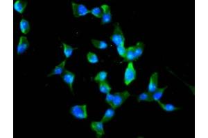 Immunofluorescence staining of SH-SY5Y cells with ABIN7168374 at 1:100, counter-stained with DAPI. (MEX3B antibody  (AA 253-375))
