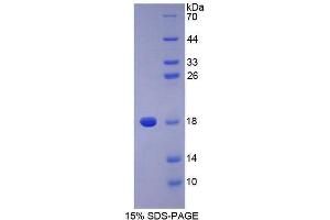 SDS-PAGE (SDS) image for Phospholipase A2, Group IIA (Platelets, Synovial Fluid) (PLA2G2A) (AA 21-144) protein (His tag) (ABIN1878604) (PLA2G2A Protein (AA 21-144) (His tag))
