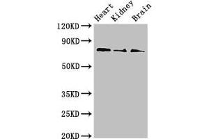 Western Blot Positive WB detected in: Mouse heart tissue, Mouse kidney tissue, Mouse brain tissue All lanes: SLC5A1 antibody at 4 μg/mL Secondary Goat polyclonal to rabbit IgG at 1/50000 dilution Predicted band size: 74, 61 kDa Observed band size: 74 kDa (SLC5A1 antibody  (AA 564-643))