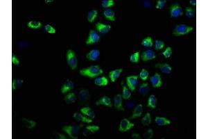 Immunofluorescence staining of Hela cells with ABIN7163516 at 1:33, counter-stained with DAPI. (ATP2B3 antibody  (AA 1057-1220))