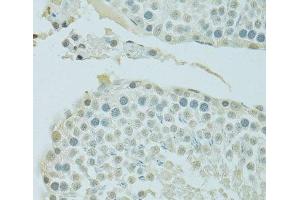 Immunohistochemistry of paraffin-embedded Rat testis using BRD3 Polyclonal Antibody at dilution of 1:100 (40x lens). (BRD3 antibody)