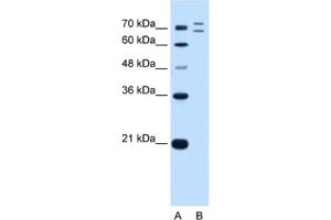 Western Blotting (WB) image for anti-Ring Finger Protein 168 (RNF168) antibody (ABIN2462696) (RNF168 antibody)