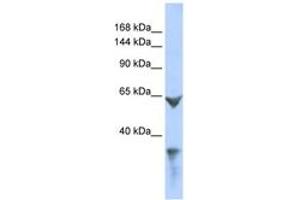 Image no. 1 for anti-Low Density Lipoprotein Receptor-Related Protein 1 (LRP1) (AA 211-260) antibody (ABIN6744286) (LRP1 antibody  (AA 211-260))