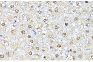 Immunohistochemistry of paraffin-embedded Rat liver using CSNK2A1 Polyclonal Antibody at dilution of 1:100 (40x lens). (CSNK2A1/CK II alpha antibody)