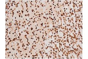 Immunohistochemistry (IHC) image for anti-Spleen tyrosine Kinase (SYK) (pTyr348) antibody (ABIN6255895)