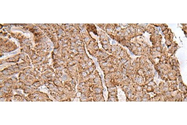 AP1S1 antibody