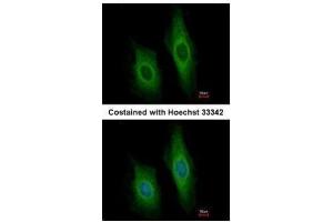 ICC/IF Image Immunofluorescence analysis of methanol-fixed HeLa, using DNase I, antibody at 1:200 dilution. (DNASE1 antibody)
