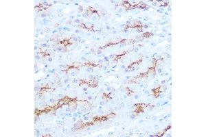 Immunohistochemistry of paraffin-embedded mouse kidney using CD138/Syndecan-1 Rabbit mAb (ABIN1683195, ABIN3018651, ABIN3018652 and ABIN7101639) at dilution of 1:100 (40x lens). (Syndecan 1 antibody)