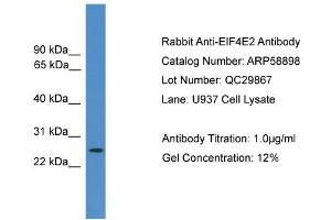 WB Suggested Anti-EIF4E2  Antibody Titration: 0. (EIF4E2 antibody  (N-Term))