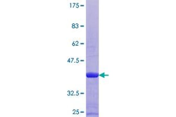 S100B Protein (AA 1-92) (GST tag)