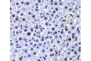 Immunohistochemistry of paraffin-embedded Mouse liver using PRKDC Polyclonal Antibody at dilution of 1:100 (40x lens).