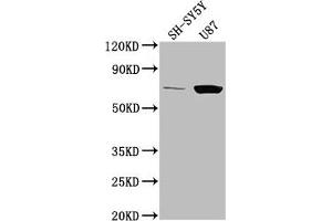 Western Blot Positive WB detected in: SH-SY5Y whole cell lysate, U87 whole cell lysate All lanes: TP73 antibody at 1:2000 Secondary Goat polyclonal to rabbit IgG at 1/50000 dilution Predicted band size: 70, 55, 54, 45, 62, 60, 65, 50, 48, 63, 39 kDa Observed band size: 70 kDa (Tumor Protein p73 antibody  (AA 537-555))