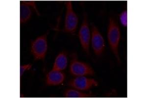 Image no. 3 for anti-Mechanistic Target of Rapamycin (serine/threonine Kinase) (mTOR) (Ser2448) antibody (ABIN319330) (MTOR antibody  (Ser2448))