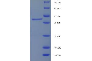 LHCGR Protein (AA 27-363) (His tag)