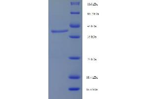 SDS-PAGE (SDS) image for Luteinizing Hormone/Choriogonadotropin Receptor (LHCGR) (AA 27-363) protein (His tag) (ABIN5709855)