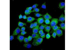 IF analysis of NMI using anti-NMI antibody (ABIN3043451). (NMI antibody  (AA 2-307))