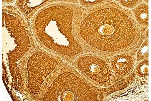 ABIN6262100 and ABIN6268913 at 1/100 staining Rat ovary tissue by IHC-P.