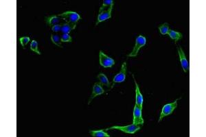 Immunofluorescent analysis of Hela cells using ABIN7175388 at dilution of 1:100 and Alexa Fluor 488-congugated AffiniPure Goat Anti-Rabbit IgG(H+L) (FLT4 antibody  (AA 1112-1329))