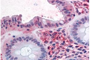 Human Colon: Formalin-Fixed, Paraffin-Embedded (FFPE) (SLC1A5 antibody  (Internal Region))