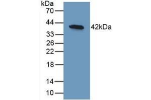 Detection of Recombinant BMP10, Human using Monoclonal Antibody to Bone Morphogenetic Protein 10 (BMP10) (BMP10 antibody  (AA 315-424))
