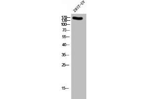 Western Blot analysis of 293T-UV cells using Phospho-NMDAε2 (Y1336) Polyclonal Antibody (GRIN2B antibody  (pTyr1336))