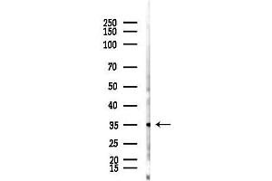 anti-Zinc Finger Protein 444 (ZNF444) antibody
