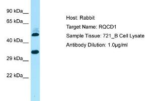 Host: Rabbit Target Name: RQCD1 Sample Type: 721_B Whole Cell lysates Antibody Dilution: 1. (RQCD1 antibody  (Middle Region))