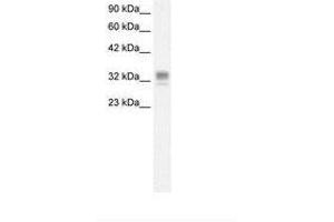Image no. 1 for anti-Asialoglycoprotein Receptor 1 (ASGR1) (AA 100-149) antibody (ABIN6736268)