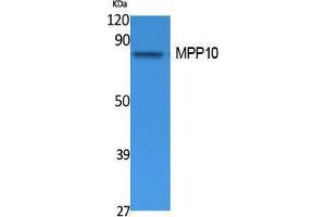 Western Blotting (WB) image for anti-M-Phase phosphoprotein 10 (U3 Small Nucleolar Ribonucleoprotein) (MPHOSPH10) (Internal Region) antibody (ABIN3178110) (MPHOSPH10 antibody  (Internal Region))