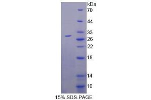 SDS-PAGE (SDS) image for Glutathione S-Transferase alpha 1 (GSTA1) (AA 2-222) protein (His tag) (ABIN1079677)