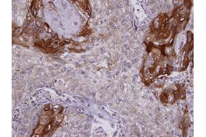 IHC-P Image Immunohistochemical analysis of paraffin-embedded TW2. (SIL1 antibody  (C-Term))