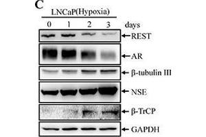 Hypoxia induces NED of LNCaP cells concomitant with down-regulation REST protein levels but not REST mRNA(A) LNCaP cells were treated with hypoxia (2 % O2) for 3 days. (BTRC antibody)