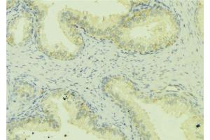 ABIN6272461 at 1/100 staining Mouse colon tissue by IHC-P. (WASF1 antibody  (Internal Region))