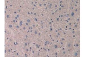 Detection of 5-LO in Human Liver Tissue using Polyclonal Antibody to 5-Lipoxygenase (5-LO) (ALOX5 antibody  (AA 461-671))