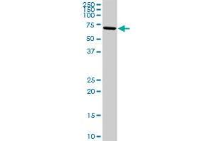 ALOX15 MaxPab rabbit polyclonal antibody. (ALOX15 antibody  (AA 1-662))