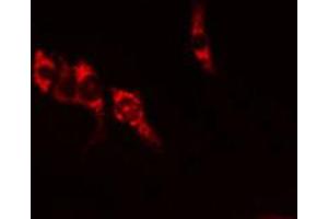 ABIN6269355 staining U-2 OS  cells by IF/ICC. (IL-10RA antibody  (C-Term))