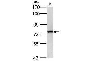 WB Image Sample (30 ug of whole cell lysate) A: 293T 7. (RecQ Protein-Like (DNA Helicase Q1-Like) (RECQL) (C-Term) antibody)