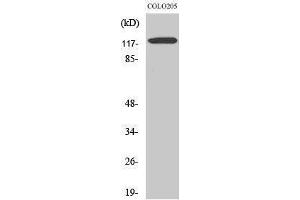 Western Blotting (WB) image for anti-Leptin Receptor (LEPR) (Internal Region) antibody (ABIN3185989) (Leptin Receptor antibody  (Internal Region))