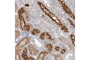 Immunohistochemical staining of human kidney with ATP11A polyclonal antibody  shows strong membranous and cytoplasmic positivity in cells in tubules. (ATP11A antibody)