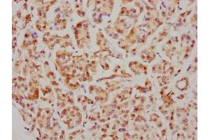IHC image of ABIN7127416 diluted at 1:126. (Recombinant CDC5L antibody)