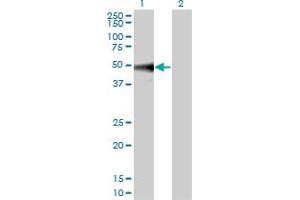 Western Blot analysis of MAPK9 expression in transfected 293T cell line by MAPK9 monoclonal antibody (M01), clone 1C1-3A8.