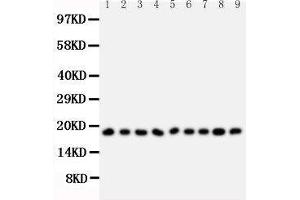 Anti-Ribonuclease A antibody, Western blotting All lanes: Anti Ribonuclease A  at 0.