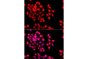 Immunofluorescence analysis of A549 cells using STXBP2 antibody. (STXBP2 antibody)