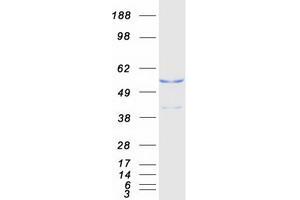 Validation with Western Blot