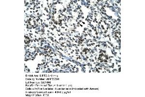 Human Lung (SIRT5 antibody  (Middle Region))