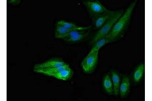 Immunofluorescent analysis of HepG2 cells using ABIN7166940 at dilution of 1:100 and Alexa Fluor 488-congugated AffiniPure Goat Anti-Rabbit IgG(H+L) (MYRIP antibody  (AA 387-689))